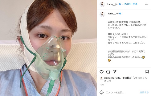 プレート除去手術を受けた伊藤かりん