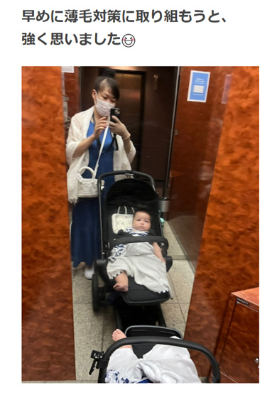 生え際にショックを受けただいたひかる