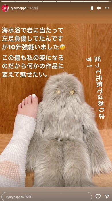 ケガをしたきゃりーぱみゅぱみゅ