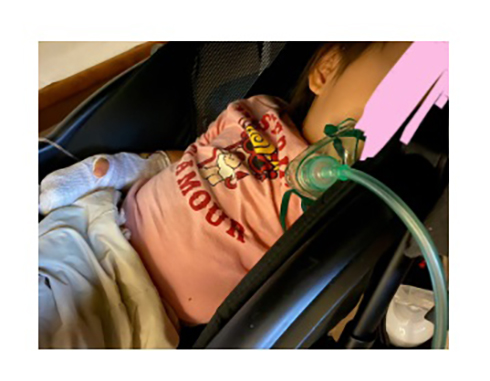 酸素ボンベ付きの娘