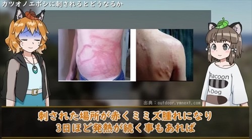 カツオノエボシ