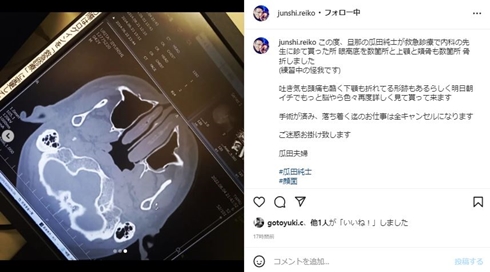 瓜田純士のレントゲン