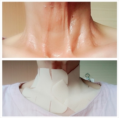 食道がんで闘病中の秋野暢子