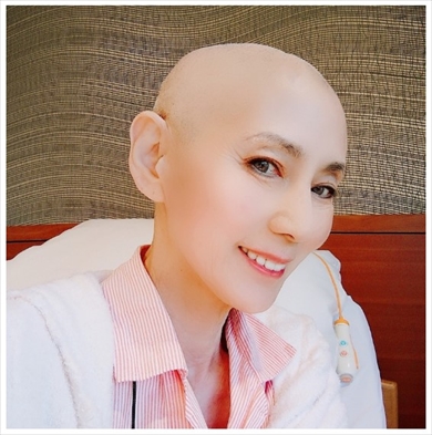 食道がんで闘病中の秋野暢子