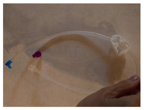 ステージ3の食道がんで闘病中の秋野暢子