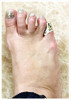 脱衣所で転倒して出血した北斗晶