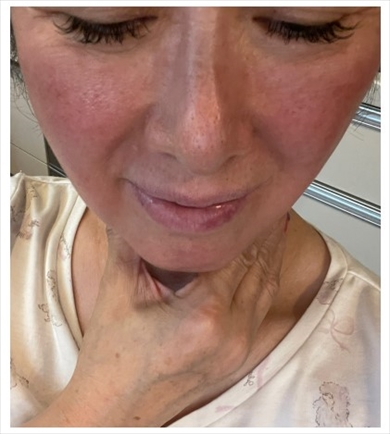 皮膚疾患と闘う内海和子