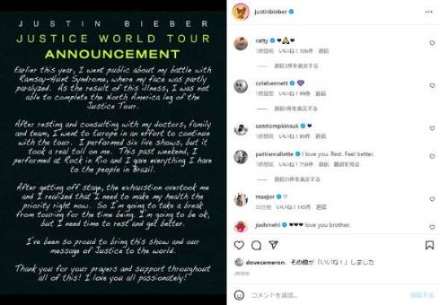 ジャスティン・ビーバーが健康上の問題でツアーをキャンセル
