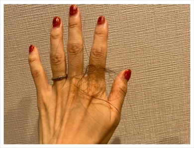 あいのり桃の産後の抜け毛