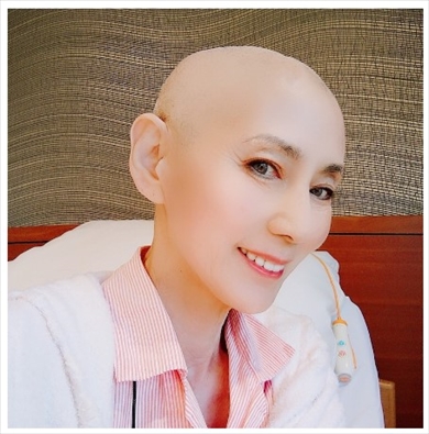 食道がんで闘病中の秋野暢子