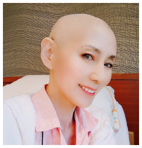 抗がん剤治療に向け髪を剃る秋野暢子