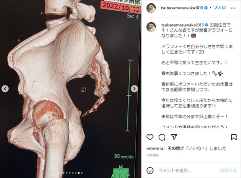 仙骨を骨折した益若つばさ