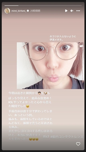 ICLの手術を受けた桐谷美玲