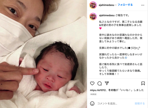 元祖“ヤマンバギャル”タレントのあぢゃ、第2男児出産