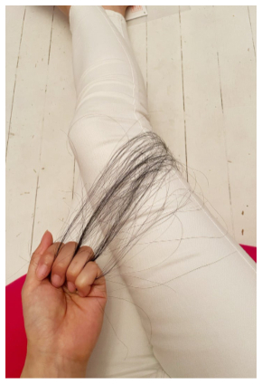 副作用で髪が抜けた原発不明癌で闘病中の本橋由