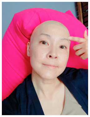 副作用で髪が抜ける前にスキンヘッドにした原発不明癌で闘病中の本橋由香