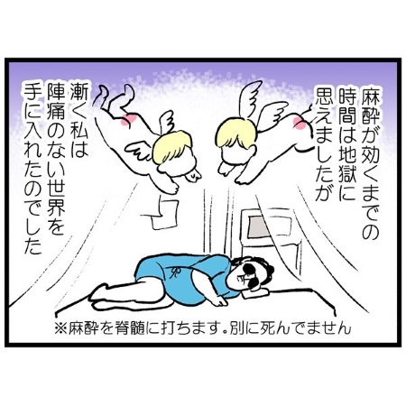 麻酔後、ようやく陣痛のない世界を手に入れた画像