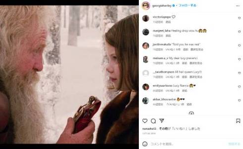 「ナルニア国物語」ジョージー・ヘンリーが手術で残った傷跡を隠し続けてきたことを告白