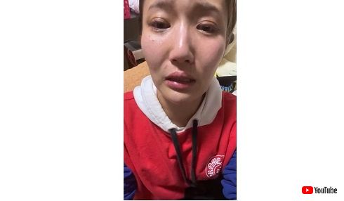 ひっかき傷を示す緒方友莉奈