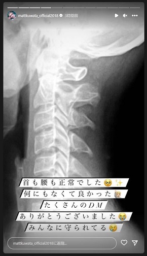 肋骨と背骨を骨折