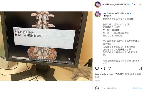 肋骨と背骨を骨折