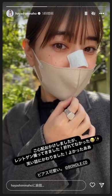 レントゲン検査後の林みなほ