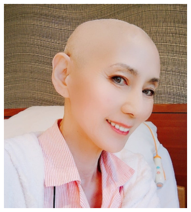 抗がん剤の副作用が出る前にスキンヘッドにした秋野暢子