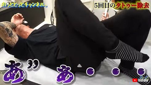 麻酔ナシの刺青除去施術にもん絶する後藤祐樹