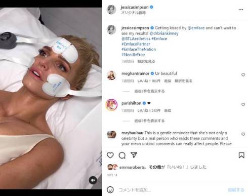 リフトアップ施術を受けるジェシカ・シンプソン