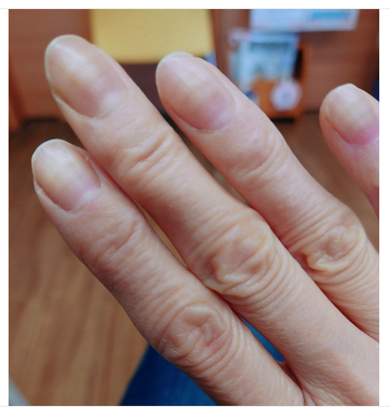 半年の闘病経て食道がんが消滅した秋野暢子がネイル挑戦