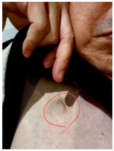 入院中の笠井信輔アナウンサー