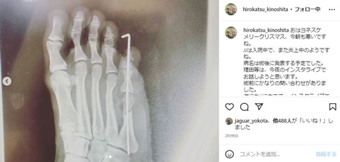 木下大維志のレントゲン