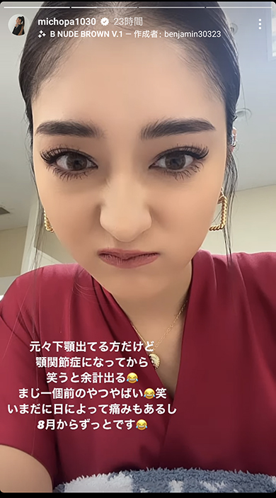 顎関節症を公表したみちょぱ