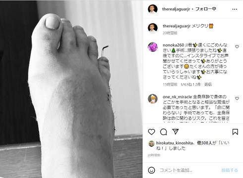 ジャガー横田の息子が受けた手術跡