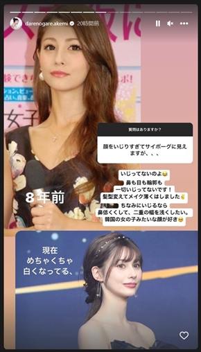 ダレノガレ明美の8年間のビフォアフター写真