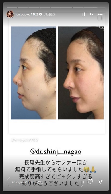 エンリケの鼻整形