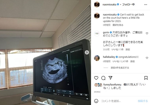 大坂なおみの妊娠発表