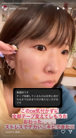 ホクロ除去後のテープを替えてしまったまあたそ