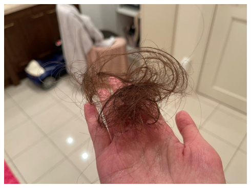 産後の抜け毛に悩む4児の母でタレントの菊池瑠々