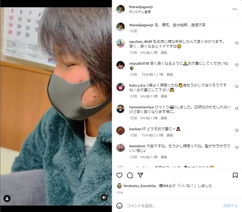 針金除去の手術を受けるジャガー横田の息子・木下大維志