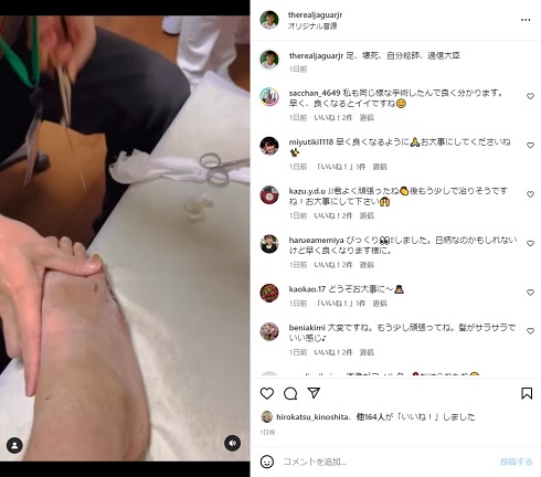 針金除去の手術を受けるジャガー横田の息子・木下大維志