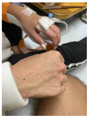 デング熱で入院中のでっぱりん