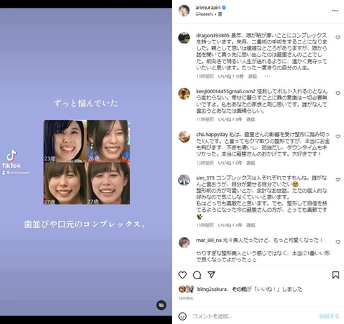 整形前の有村藍里