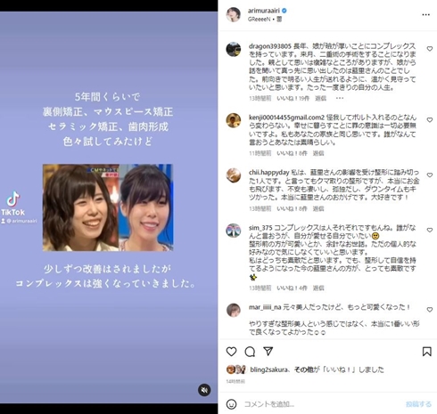 整形前の有村藍里