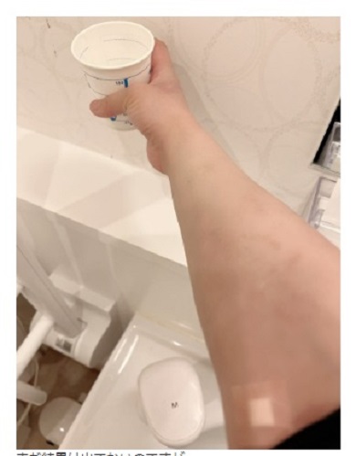 検査中の華原朋美