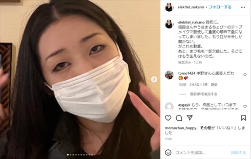 重度の眼瞼下垂を告白した「日本エレキテル連合」の中野聡子