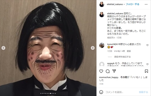 重度の眼瞼下垂を告白した「日本エレキテル連合」の中野聡子