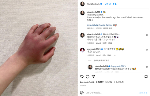 武田梨奈さんの拳