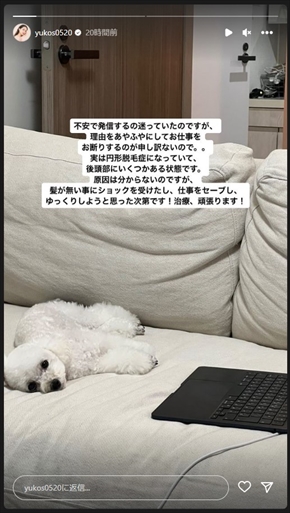 円形脱毛症を告白した菅本裕子