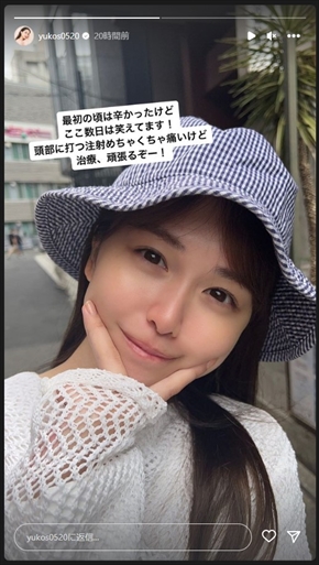 円形脱毛症を告白した菅本裕子